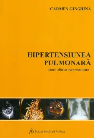 Hipertensiunea pulmonară - Istorii clinice surprin...