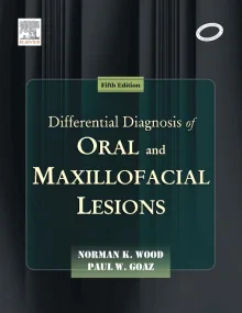 Differential Diagnosis of Oral and Maxillofacial L...