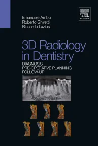 3D radiology in dentistry - Diagnosis Pre-operativ...