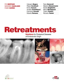 Retreatment - Solutions for periapical diseases of...