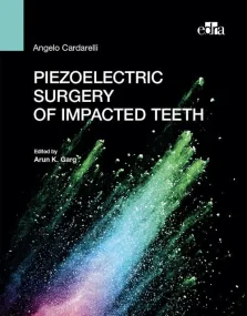 Piezoelectric surgery of impacted teeth