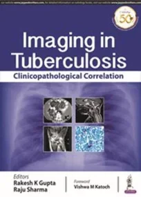Imaging in Tuberculosis