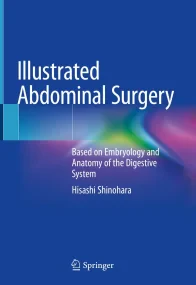 Illustrated Abdominal Surgery: Based on Embryology...