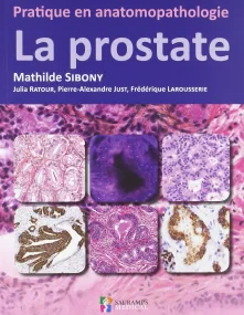 LA PROSTATE PRATIQUE EN ANATOMOPATHOLOGIE