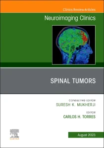 Spinal Tumors, An Issue of Neuroimaging Clinics of...
