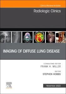 Imaging of Diffuse Lung Disease, An Issue of Radio...