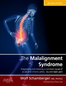 The Malalignment Syndrome