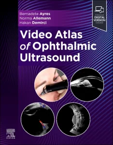 Video Atlas of Ophthalmic Ultrasound
