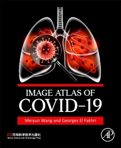 Image Atlas of COVID-19