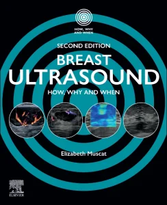 Breast Ultrasound