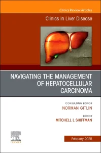 Navigating the Management of Hepatocellular Carcin...