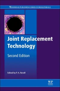Joint Replacement Technology