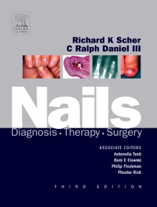 Nails