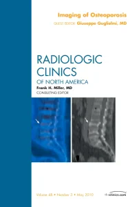 Imaging of Osteoporosis, An Issue of Radiologic Cl...