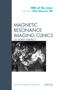 MRI of the Liver, An Issue of Magnetic Resonance I...