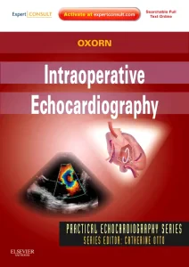 Intraoperative Echocardiography
