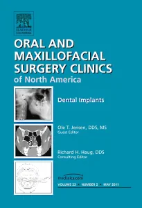 Dental Implants, An Issue of Oral and Maxillofacia...