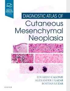 Diagnostic Atlas of Cutaneous Mesenchymal Neoplasi...